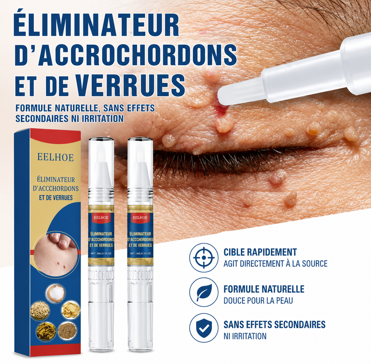 Le stylo qui efface verrues et accrocheurs sans douleur ni médecin