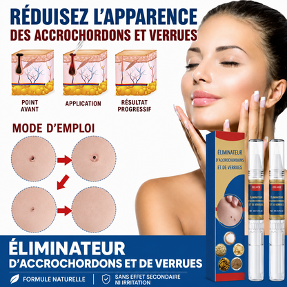 Le stylo qui efface verrues et accrocheurs sans douleur ni médecin